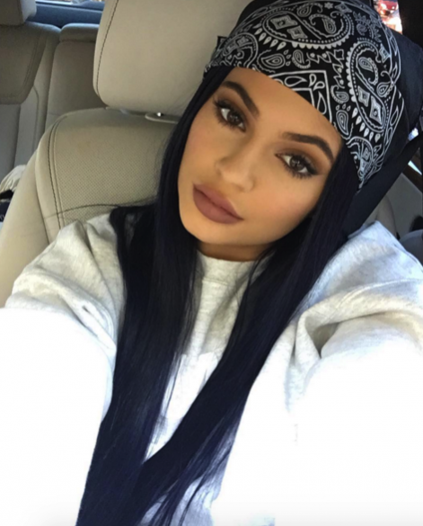 did-kylie-jenner-get-lip-injections.png